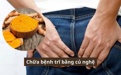 Chữa bệnh trĩ bằng củ nghệ có hiệu quả không? Sử dụng bằng cách nào?