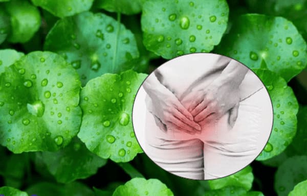 Dùng rau má chữa bệnh trĩ có thực sự hiệu quả không?